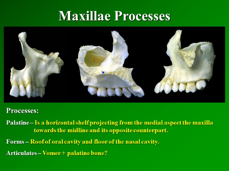 Maxillae Processes   Processes: Palatine – Is a horizontal shelf projecting from the
